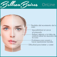 Curso Online de Tratamientos Alternativos para Parálisis Facial Curso Online de Tratamientos Alternativos para Parálisis Facial